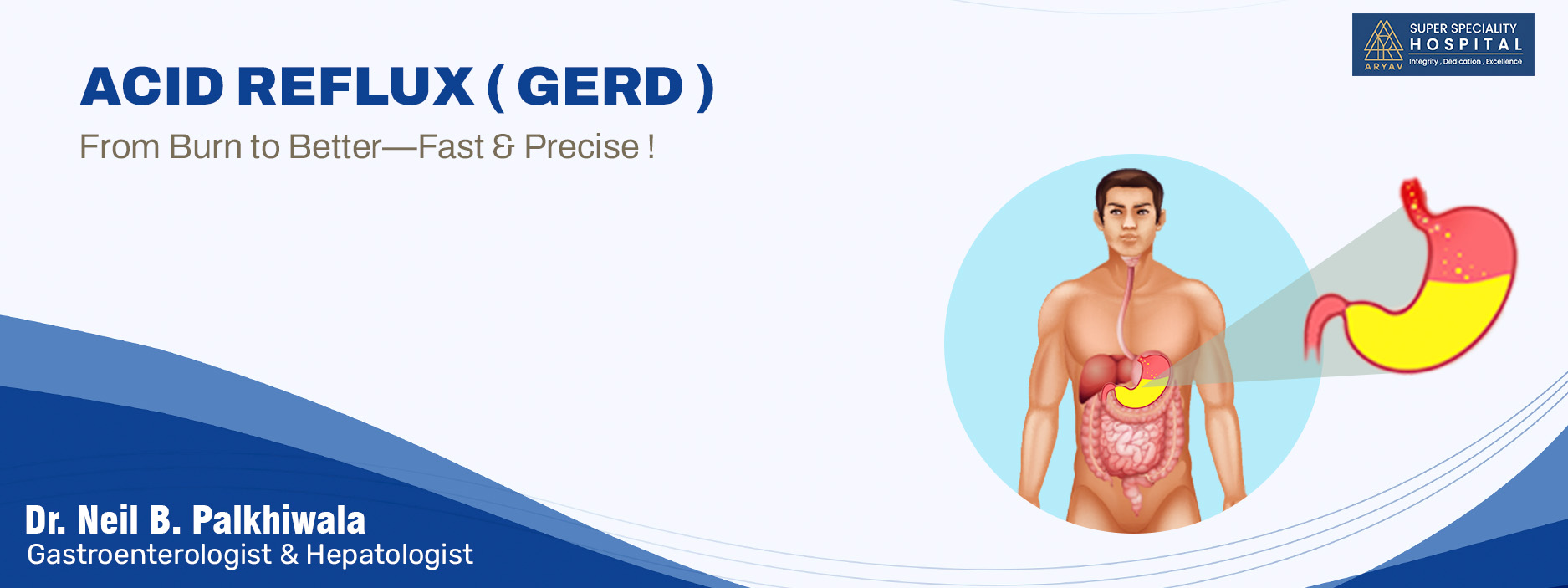 ACID Reflux ( GERD ) Treatment